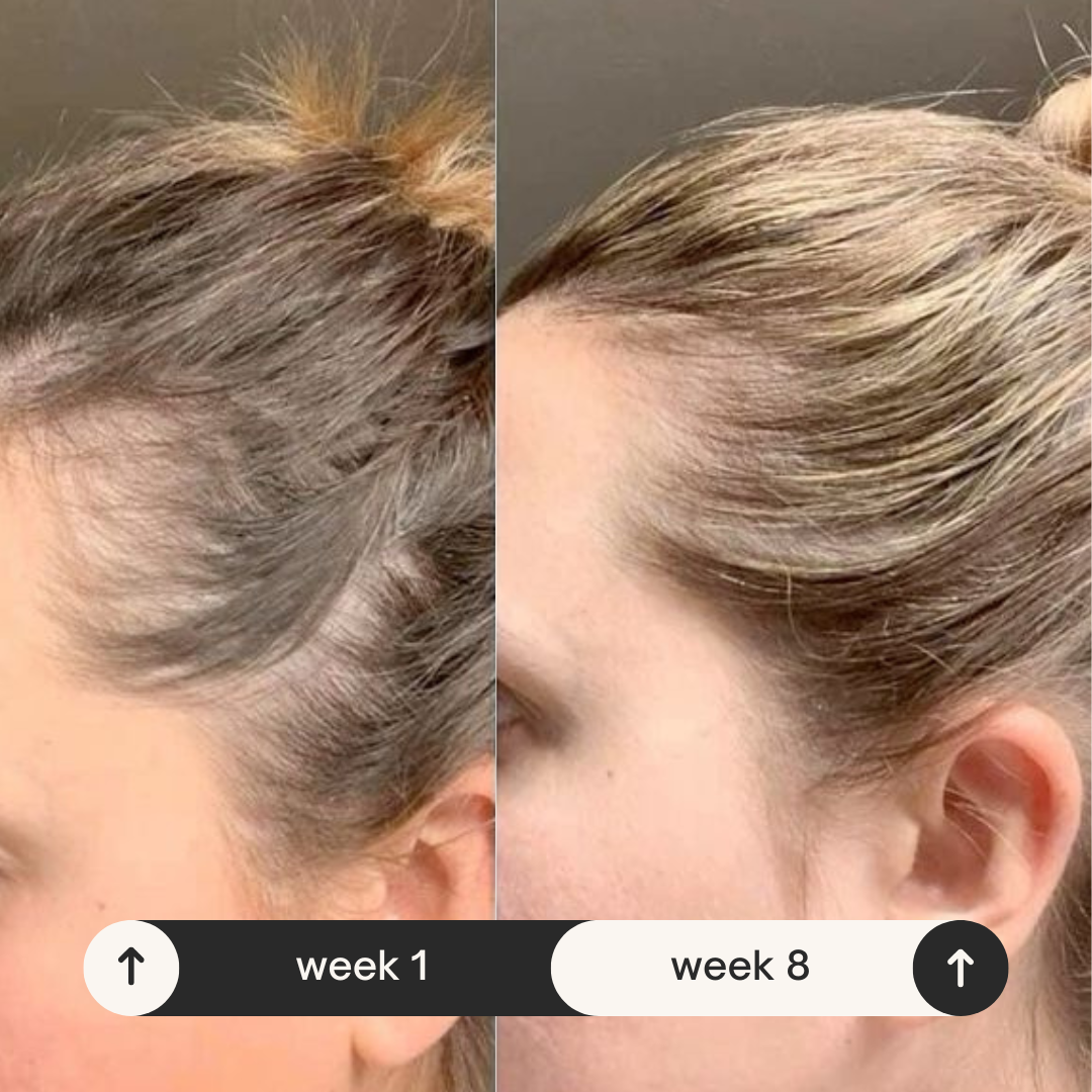 Natural Hair Growth Serum for Hair Loss Treatment