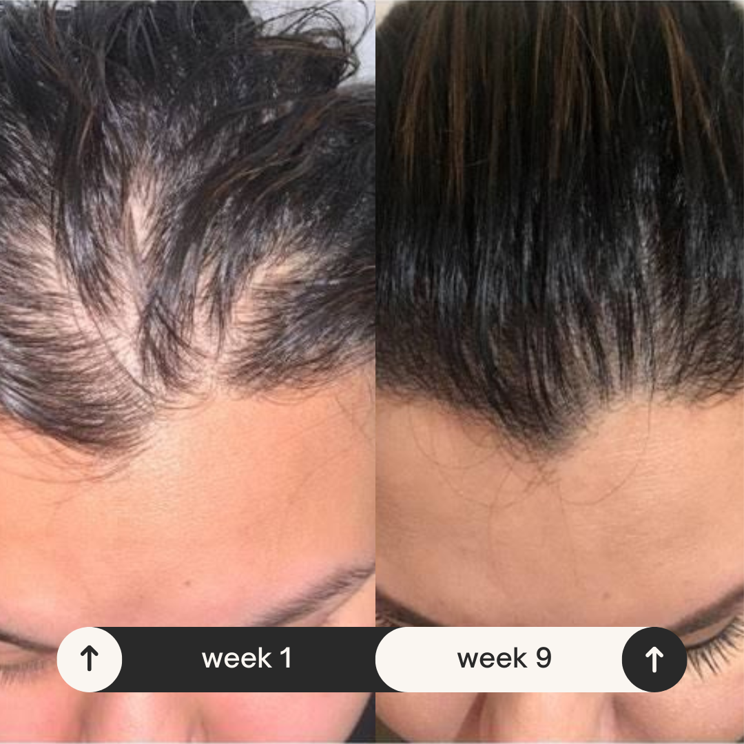 Natural Hair Growth Serum for Hair Loss Treatment