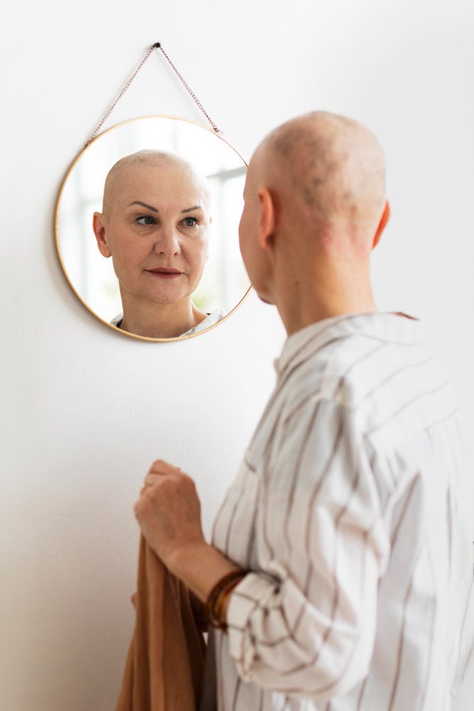 How to Treat Female Hair Loss: A Comprehensive Guide - Praela