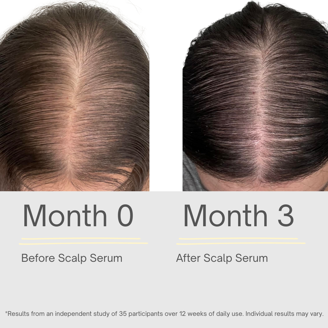 Hair Growth Serum - 118ml