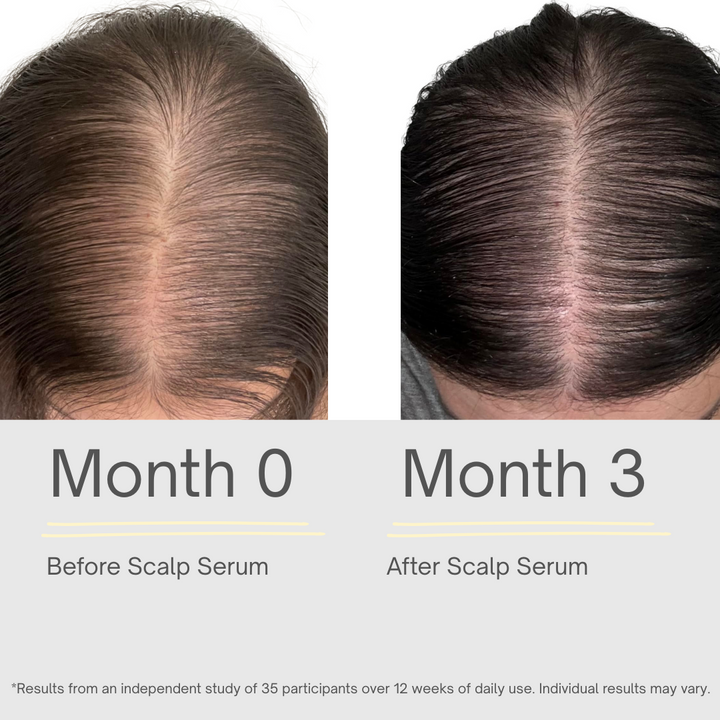 Hair Growth Serum - 118ml
