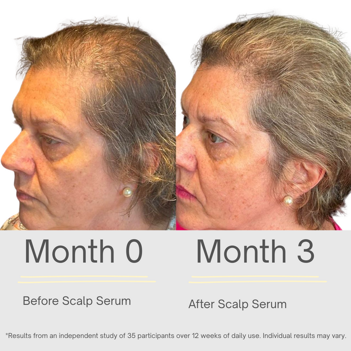 Hair Growth Serum - 118ml