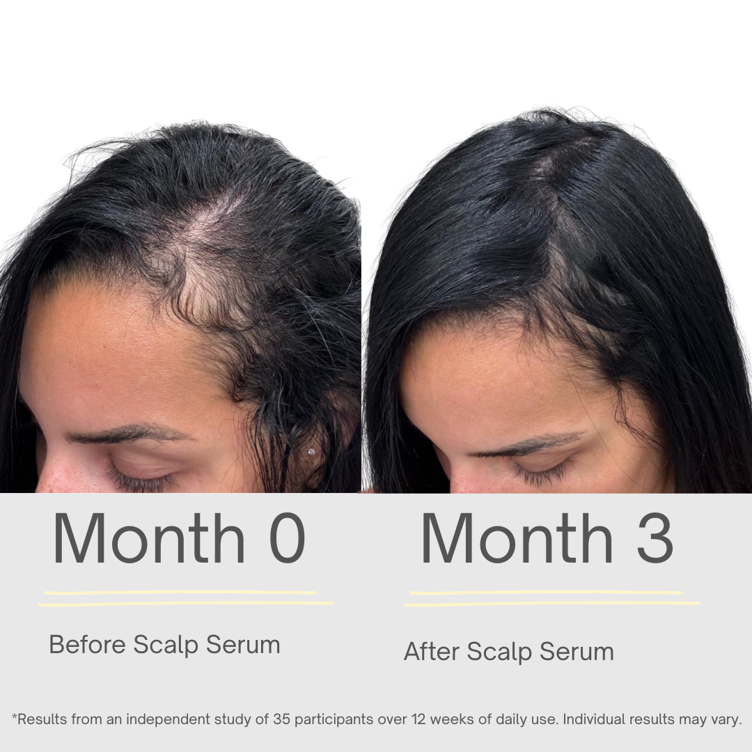 Hair Growth Serum - 118ml