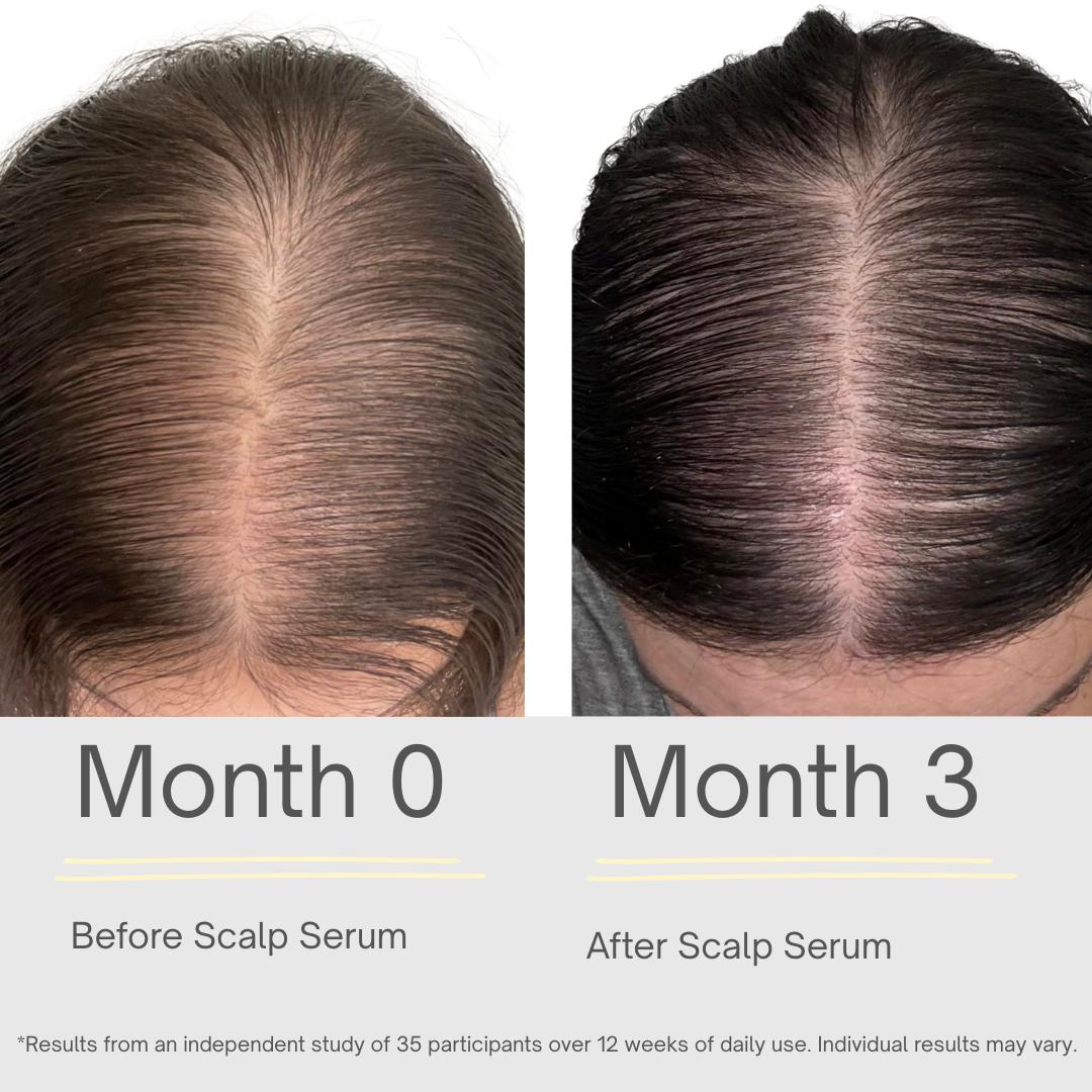 Hair Growth Serum - 118ml