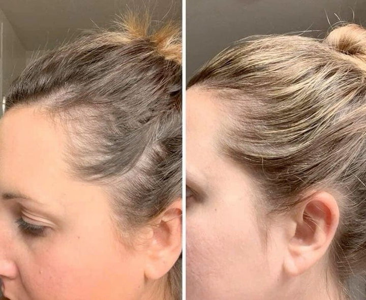 best hair serum for hair growth
